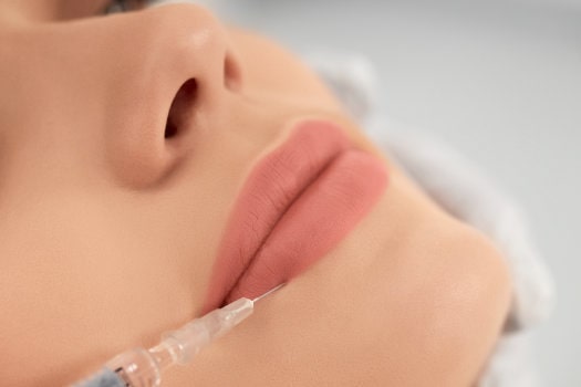 Tudo o que você precisa saber sobre preenchimento labial